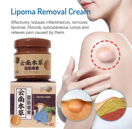 20g Treatment Lipoma Removal Body Cream Remover Treatment Medicine Liquid Apply To Skin Swelling Cellulite Fibroma Fat Mass Plaster Plasters Bandage